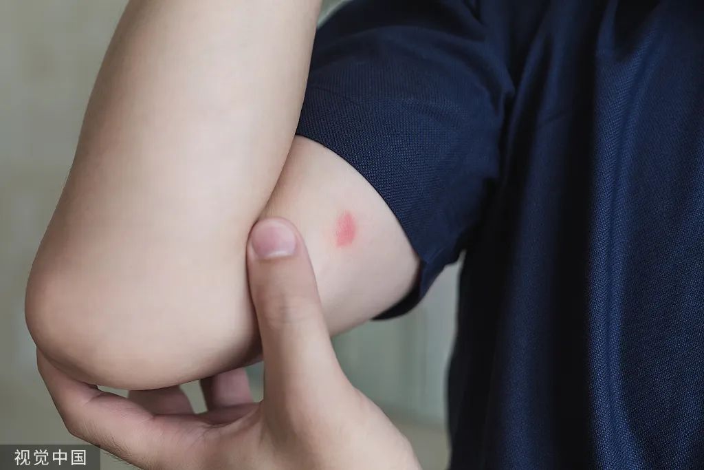 遇到这几种虫子,千万别拍死!否则后果可能会很严重……(图1) 68.jpg