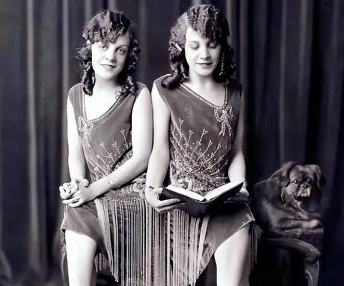 英国臀部连体姐妹:各自有男友,姐姐死后,妹妹拖着遗体2天后才去世……(图2) 2.png