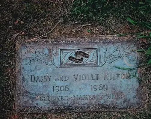 英国臀部连体姐妹:各自有男友,姐姐死后,妹妹拖着遗体2天后才去世……(图5) 5.jpg