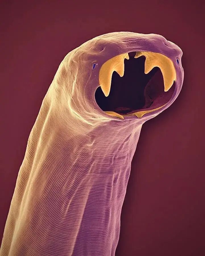 小小的微生物放大了竟然如此可怕——显微镜下的微型生物(图12) 14.jpg