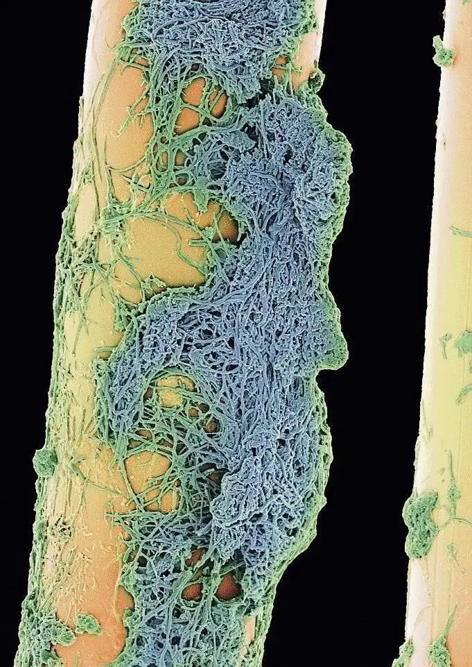 小小的微生物放大了竟然如此可怕——显微镜下的微型生物(图15) 17.jpg