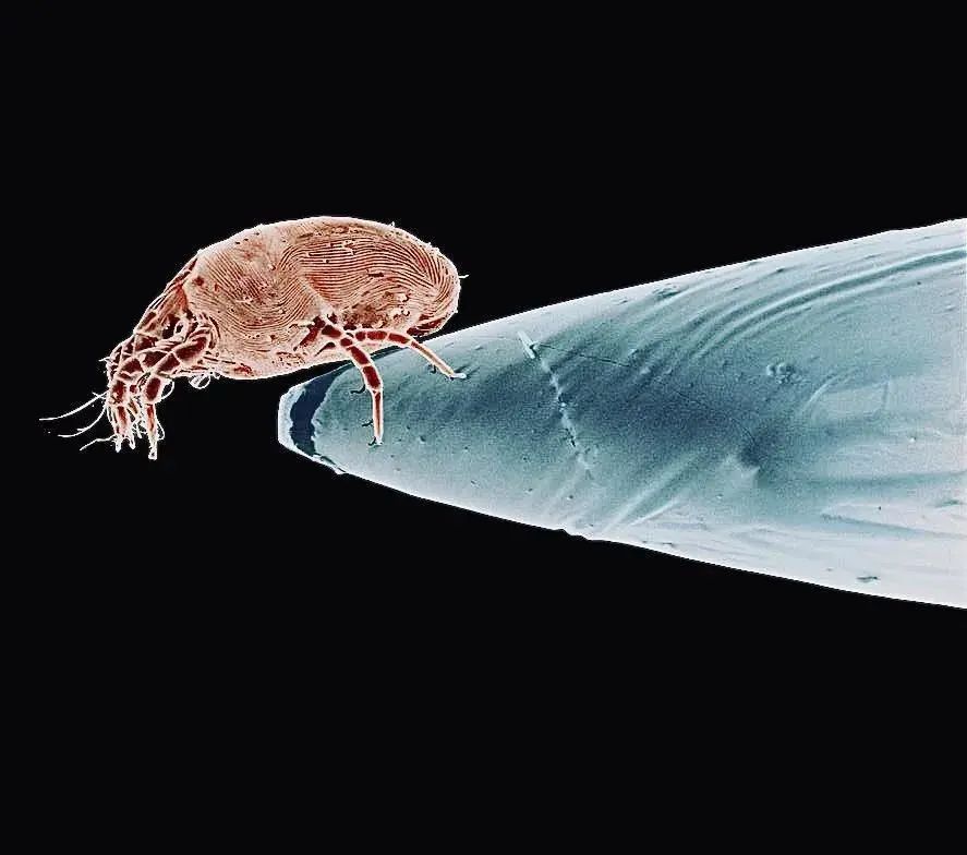 小小的微生物放大了竟然如此可怕——显微镜下的微型生物(图1) 3.jpg