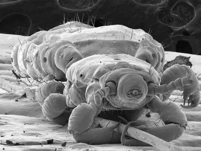 小小的微生物放大了竟然如此可怕——显微镜下的微型生物(图17) 19.jpg