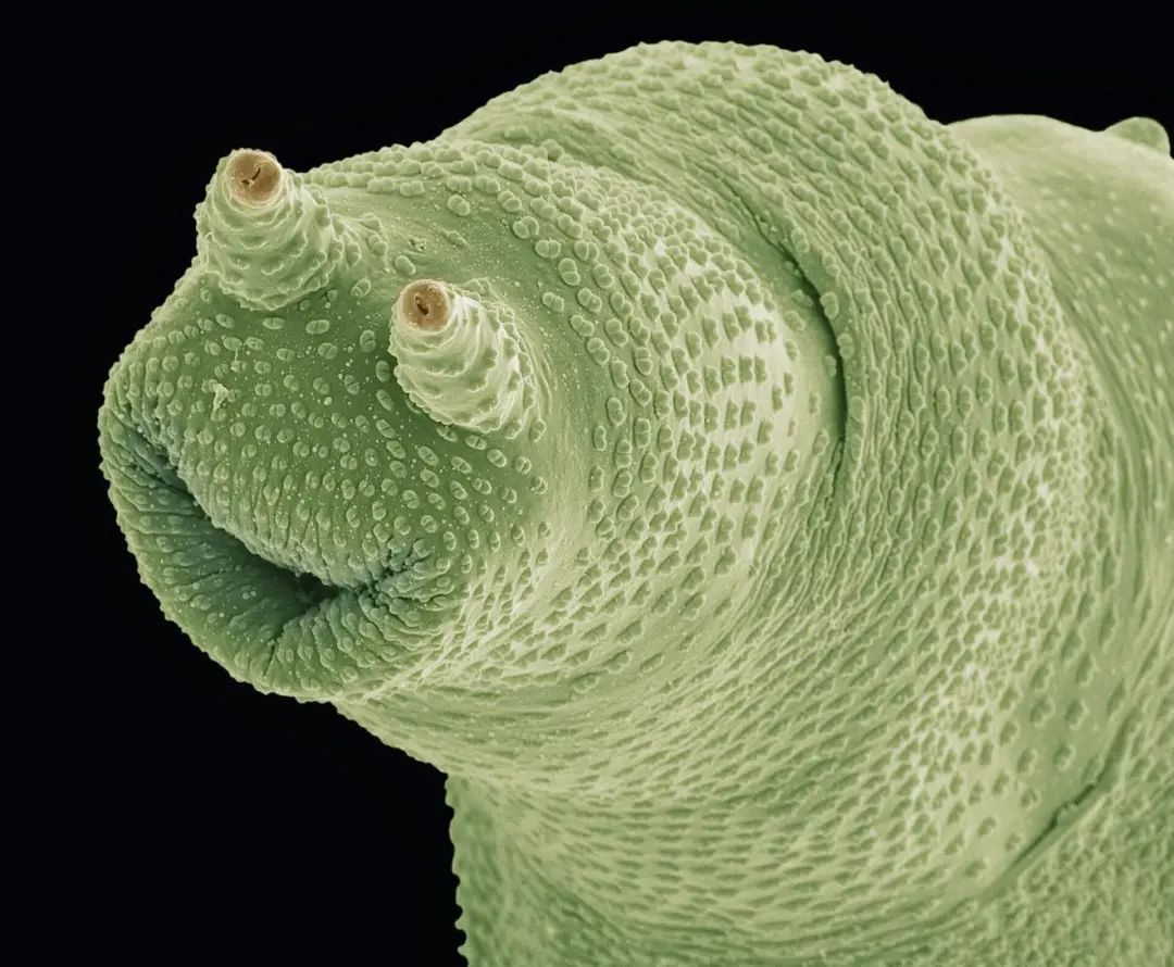 小小的微生物放大了竟然如此可怕——显微镜下的微型生物(图18) 20.jpg