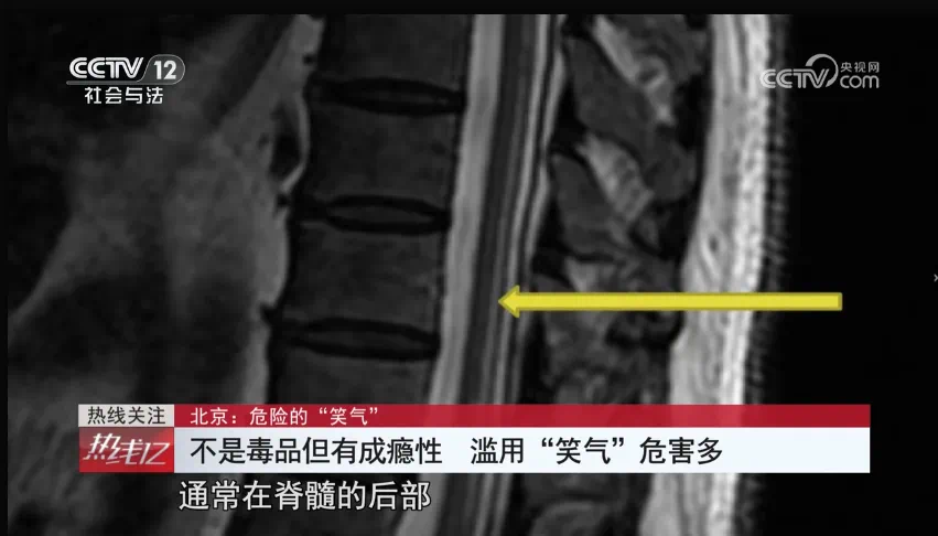 成瘾、致幻,严重可致死!它不是毒品,却像毒品一样危险(图8) 7.png
