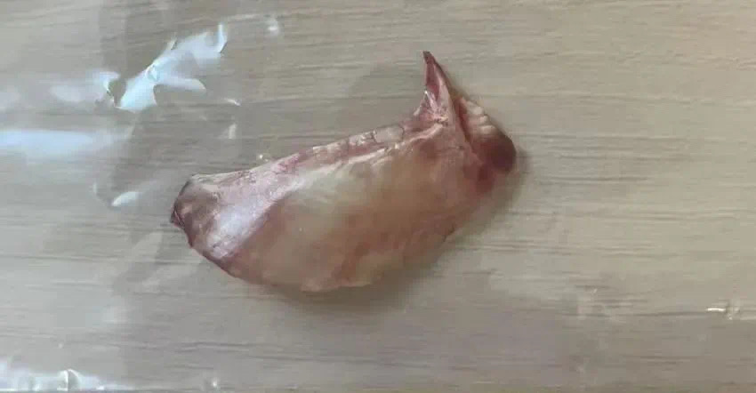 直插心脏!男子吃饭时一个动作,差点闯大祸(图4) 333.png