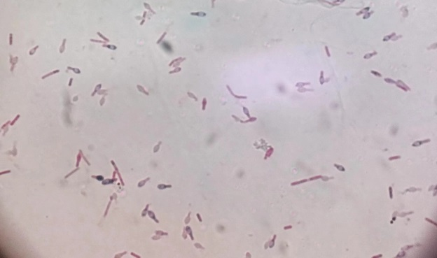 放进真空袋,就不怕食物过期了?这个隐患很多人都忽略了......(图3) 放进真空袋,就不怕食物过期了?这个隐患很多人都忽略了......(图3)