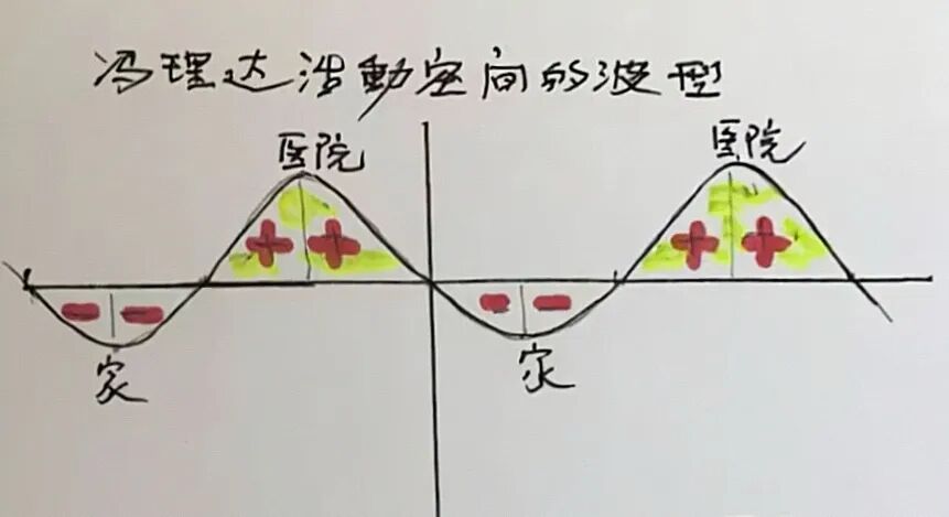 金日光教授:(八十一|中)永不忘当年钱老劝导我们“用当代科学传承《黄帝内经》医理和建立《中药本草》科学药理标准”的教导(图6) 金日光教授:(八十一|中)永不忘当年钱老劝导我们“用当代科学传承《黄帝内经》医理和建立《中药本草》科学药理标准”的教导(图6)